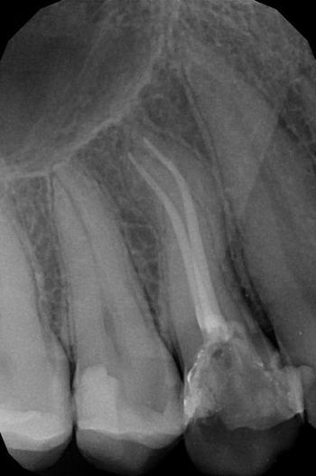 endodoncja mikroskopowa 1